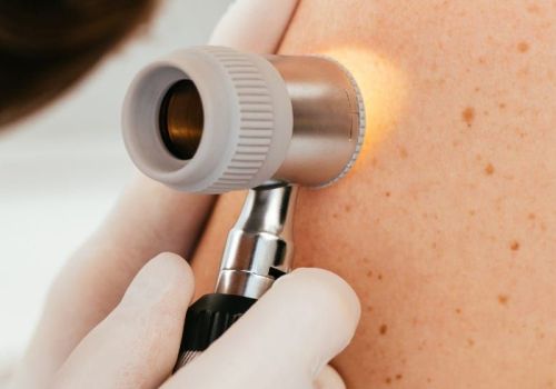 Petite-chirurgie-dermato.jpg