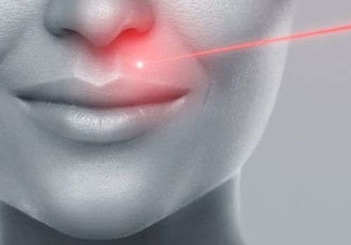 laser_pour_le_photorajeunissement.jpg