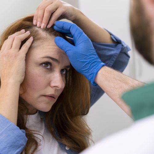 Greffe-de-cheveux-FUE-pour-femmes-scaled.jpg